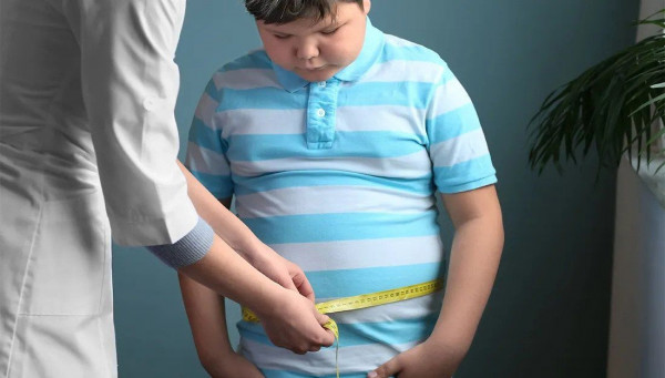 obesitas pada anak